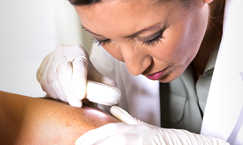 A dermatologist examines a patient's skin using a dermatoscope.
